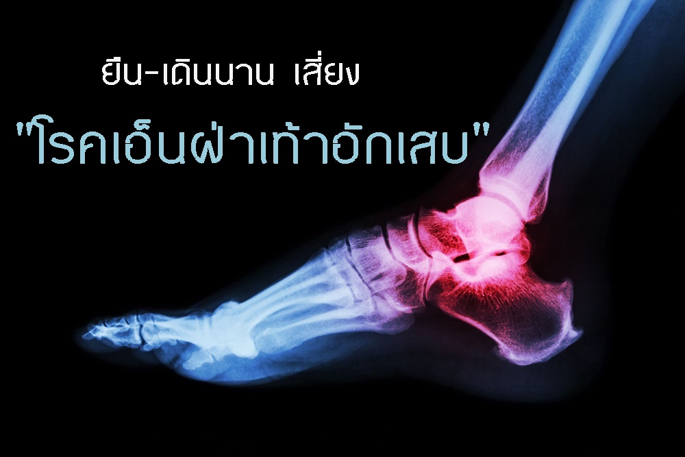 ยืน-เดินนาน เสี่ยง