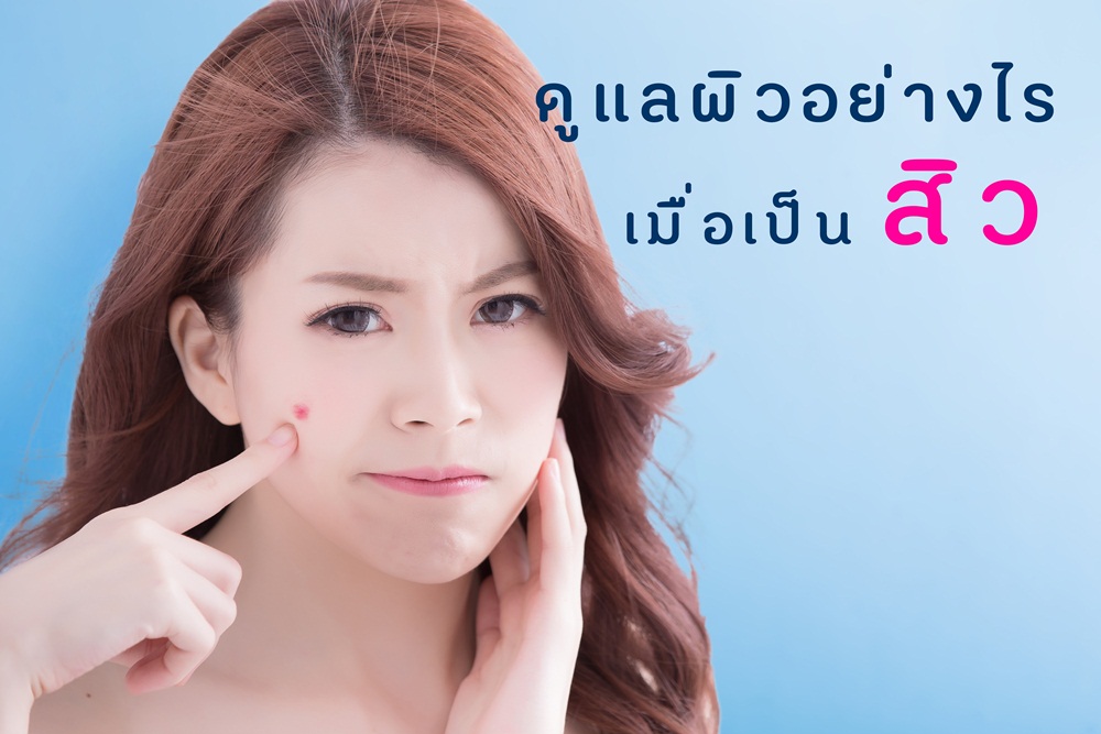 ดูแลผิวอย่างไร เมื่อเป็นสิว thaihealth