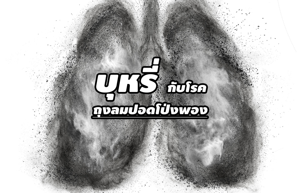 บุหรี่ กับโรคถุงลมปอดโป่งพอง thaihealth