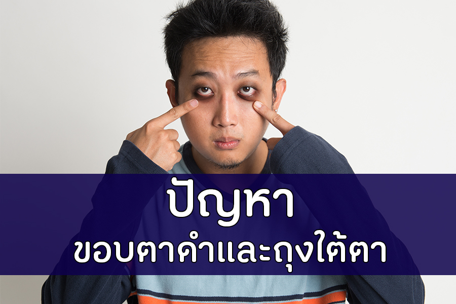 ปัญหาขอบตาดำและถุงใต้ตา thaihealth
